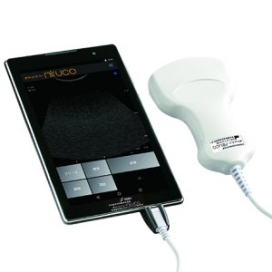 Post Thumbnail of 日本シグマックス、タブレット型の超音波画像診断装置「ポケットエコー miruco (ミルコ)」発表、価格169,900円で販売開始